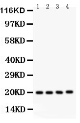 PARK7 / DJ-1 Antibody - PARK7 antibody Western blot. All lanes: Anti PARK7 at 0.5 ug/ml. Lane 1: PANC Whole Cell Lysate at 40 ug. Lane 2: U20S Whole Cell Lysate at 40 ug. Lane 3: SMMC Whole Cell Lysate at 40 ug. Lane 4: HELA Whole Cell Lysate at 40 ug. Predicted band size: 20 kD. Observed band size: 20 kD.