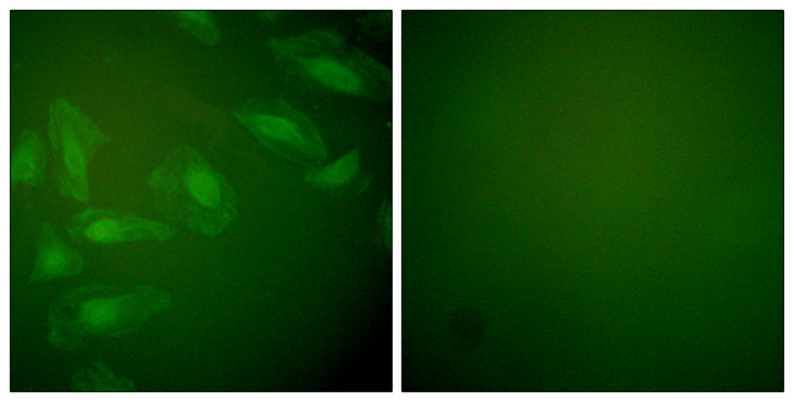PARK7 / DJ-1 Antibody - Immunofluorescence analysis of HeLa cells, using DJ-1 Antibody. The picture on the right is blocked with the synthesized peptide.
