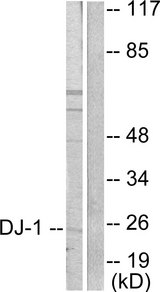 PARK7 / DJ-1 Antibody - Western blot analysis of lysates from HUVEC cells, using DJ-1 Antibody. The lane on the right is blocked with the synthesized peptide.