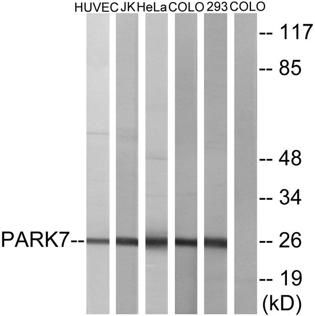 PARK7 / DJ-1 Antibody - Western blot analysis of lysates from HUVEC, JurKat, HeLa, COLO205, and 293 cells, using PARK7 Antibody. The lane on the right is blocked with the synthesized peptide.