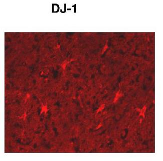 PARK7 / DJ-1 Antibody - DJ-1 detected in human cortex (immunocytochemistry).