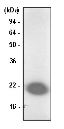 PARK7 / DJ-1 Antibody - Jurkat cell lysate was resolved by SDS-PAGE, transferred to PVDF membrane and probed with anti-human Park7/DJ-1 antibody (1:1000). Protein was visualized using a goat anti-mouse secondary antibody conjugated to HRP and aN ECL detection system.
