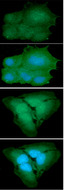 PARK7 / DJ-1 Antibody - ICC/IF analysis of PARK7 in Hep3B cells line, stained with DAPI (Blue) for nucleus staining and monoclonal anti-human PARK7 antibody (1:100) with goat anti-mouse IgG-Alexa fluor 488 conjugate (Green).ICC/IF analysis of PARK7 in HeLa cells line, stained with DAPI (Blue) for nucleus staining and monoclonal anti-human PARK7 antibody (1:100) with goat anti-mouse IgG-Alexa fluor 488 conjugate (Green).