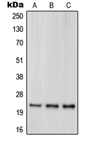 PARK7 / DJ-1 Antibody - Western blot analysis of DJ-1 expression in HeLa (A); HEK293T (B); Jurkat (C) whole cell lysates.