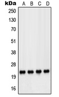 PARK7 / DJ-1 Antibody - Western blot analysis of DJ-1 expression in HeLa (A); Jurkat (B); COLO205 (C); PC12 (D) whole cell lysates.