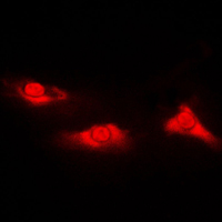 PARK7 / DJ-1 Antibody - Immunofluorescent analysis of DJ-1 staining in Jurkat cells. Formalin-fixed cells were permeabilized with 0.1% Triton X-100 in TBS for 5-10 minutes and blocked with 3% BSA-PBS for 30 minutes at room temperature. Cells were probed with the primary antibody in 3% BSA-PBS and incubated overnight at 4 C in a humidified chamber. Cells were washed with PBST and incubated with a DyLight 594-conjugated secondary antibody (red) in PBS at room temperature in the dark. DAPI was used to stain the cell nuclei (blue).