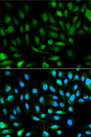 PARK7 / DJ-1 Antibody - Immunofluorescence analysis of HeLa cells using PARK7 antibody. Blue: DAPI for nuclear staining.