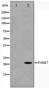 PARK7 / DJ-1 Antibody - Western blot of HUVEC cell lysate using PARK7 Antibody
