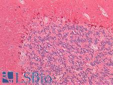 PARK7 / DJ-1 Antibody - Human Brain, Cerebellum: Formalin-Fixed, Paraffin-Embedded (FFPE)