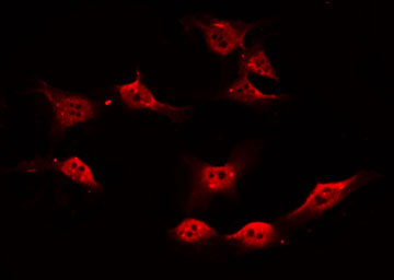 PARK7 / DJ-1 Antibody - Staining HuvEc cells by IF/ICC. The samples were fixed with PFA and permeabilized in 0.1% Triton X-100, then blocked in 10% serum for 45 min at 25°C. The primary antibody was diluted at 1:200 and incubated with the sample for 1 hour at 37°C. An Alexa Fluor 594 conjugated goat anti-rabbit IgG (H+L) Ab, diluted at 1/600, was used as the secondary antibody.