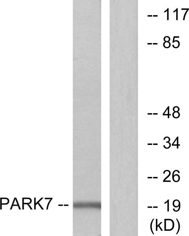 PARK7 / DJ-1 Antibody - Western blot analysis of extracts from HT-29 cells, using PARK7 antibody.