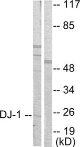 PARK7 / DJ-1 Antibody - Western blot analysis of extracts from HuvEc cells, using DJ-1 antibody.
