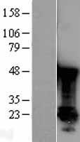 PARK7 / DJ-1 Protein - Western validation with an anti-DDK antibody * L: Control HEK293 lysate R: Over-expression lysate