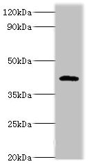 PARL / PSARL Antibody - Western blot All lanes: PARL antibody at 6µg/ml + NIH/3T3 whole cell lysate Secondary Goat polyclonal to rabbit IgG at 1/10000 dilution Predicted band size: 43, 37 kDa Observed band size: 47 kDa