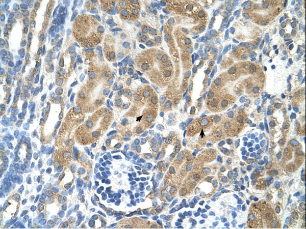 PARL / PSARL Antibody - PARL antibody PARL(presenilin associated, rhomboid-like) Antibody was used in IHC to stain formalin-fixed, paraffin-embedded human kidney.  This image was taken for the unconjugated form of this product. Other forms have not been tested.