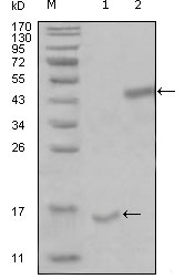 PARL / PSARL Antibody - Western blot using PARL mouse monoclonal antibody against truncated Trx-PARL recombinant protein (1) and truncated MBP-PARL(aa112-167) recombinant protein (2).