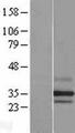 PARL / PSARL Protein - Western validation with an anti-DDK antibody * L: Control HEK293 lysate R: Over-expression lysate