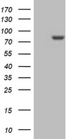 PARN Antibody - HEK293T cells were transfected with the pCMV6-ENTRY control (Left lane) or pCMV6-ENTRY PARN (Right lane) cDNA for 48 hrs and lysed. Equivalent amounts of cell lysates (5 ug per lane) were separated by SDS-PAGE and immunoblotted with anti-PARN.