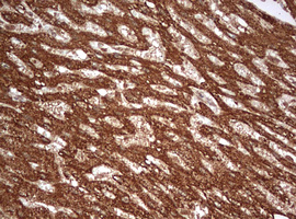 PARN Antibody - IHC of paraffin-embedded Human liver tissue using anti-PARN mouse monoclonal antibody. (Heat-induced epitope retrieval by 10mM citric buffer, pH6.0, 120°C for 3min).