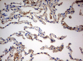 PARN Antibody - IHC of paraffin-embedded Human lung tissue using anti-PARN mouse monoclonal antibody. (Heat-induced epitope retrieval by 10mM citric buffer, pH6.0, 120°C for 3min).