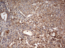 PARN Antibody - IHC of paraffin-embedded Human endometrium tissue using anti-PARN mouse monoclonal antibody. (Heat-induced epitope retrieval by 10mM citric buffer, pH6.0, 120°C for 3min).