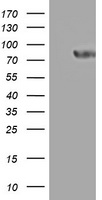 PARN Antibody - HEK293T cells were transfected with the pCMV6-ENTRY control (Left lane) or pCMV6-ENTRY PARN (Right lane) cDNA for 48 hrs and lysed. Equivalent amounts of cell lysates (5 ug per lane) were separated by SDS-PAGE and immunoblotted with anti-PARN.