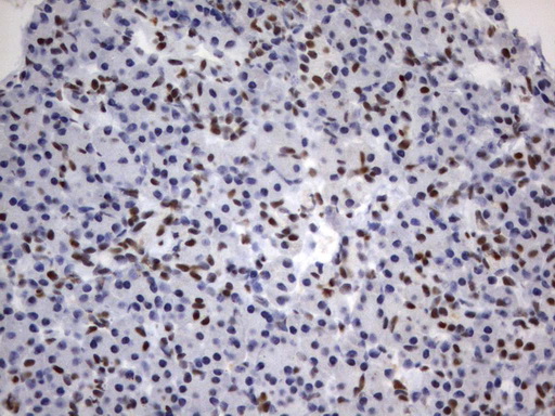 PARN Antibody - Immunohistochemical staining of paraffin-embedded Human pancreas tissue using anti-PARN mouse monoclonal antibody.  heat-induced epitope retrieval by 10mM citric buffer, pH9.0, 120C for 3min)