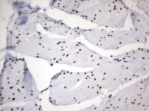 PARN Antibody - Immunohistochemical staining of paraffin-embedded Human bladder tissue using anti-PARN mouse monoclonal antibody.  heat-induced epitope retrieval by 10mM citric buffer, pH9.0, 120C for 3min)