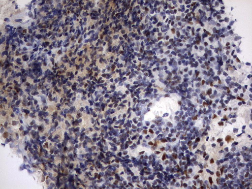 PARN Antibody - Immunohistochemical staining of paraffin-embedded Human lymph node tissue using anti-PARN mouse monoclonal antibody.  heat-induced epitope retrieval by 10mM citric buffer, pH9.0, 120C for 3min)
