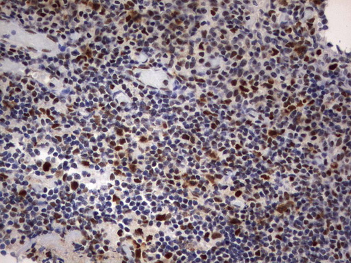 PARN Antibody - Immunohistochemical staining of paraffin-embedded Human tonsil using anti-PARNmouse monoclonal antibody.  heat-induced epitope retrieval by 10mM citric buffer, pH9.0, 120C for 3min)