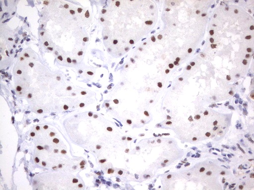 PARN Antibody - Immunohistochemical staining of paraffin-embedded Human Kidney tissue using anti-PARN mouse monoclonal antibody.  heat-induced epitope retrieval by 10mM citric buffer, pH9.0, 120C for 3min)