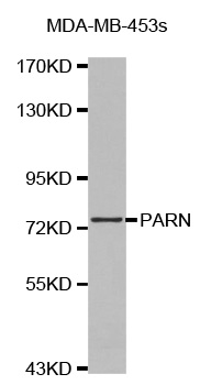 PARN Antibody - Western blot analysis of extracts of MDA-MB-453s cell lines, using PARN antibody.