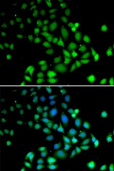 PARN Antibody - Immunofluorescence analysis of U20S cells.