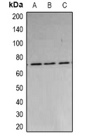 PARN Antibody - Western blot analysis of PARN expression in A549 (A); MCF7 (B); HepG2 (C) whole cell lysates.