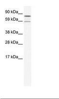 PARN Antibody - SP2/0 Cell Lysate.  This image was taken for the unconjugated form of this product. Other forms have not been tested.
