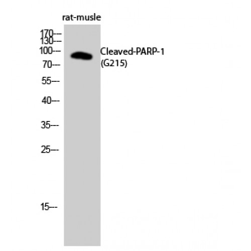 PARP1 Antibody - Western blot of Cleaved-PARP-1 (G215) antibody