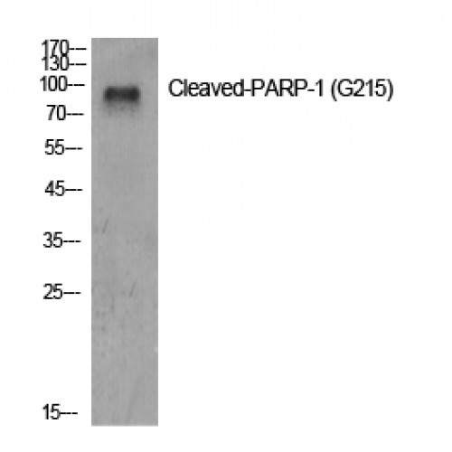 PARP1 Antibody - Western blot of Cleaved-PARP-1 (G215) antibody