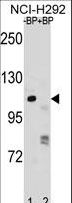 PARP1 Antibody - PARP1 Antibody pre-incubated without(lane 1) and with(lane 2) blocking peptide in NCI-H292 cell line lysate. PARP1 Antibody (arrow) was detected using the purified antibody.