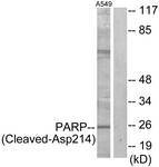 PARP1 Antibody - Western blot of extracts from A549 cells, treated with etoposide 25 uM 24h, using PARP (Cleaved-Asp214) Antibody. The lane on the right is treated with the synthesized peptide.