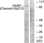 PARP1 Antibody - Western blot of extracts from NIH-3T3 cells, treated with etoposide 25 uM 1h, using PARP (Cleaved-Gly215) Antibody. The lane on the right is treated with the synthesized peptide.