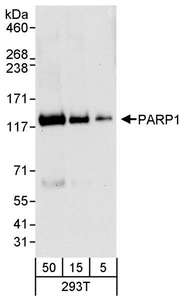 PARP1 Antibody - Detection of Human PARP1 by Western Blot. Samples: Whole cell lysate (5, 15 and 50 ug) from 293T cells. Antibody: Affinity purified rabbit anti-PARP1 antibody used for WB at 0.04 ug/ml. Detection: Chemiluminescence with an exposure time of 30 seconds.