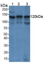 PARP1 Antibody - Western Blot; Sample: Lane1: Human Jurkat Cells; Lane2: Human K562 Cells; Lane3: Human Raji Cells.