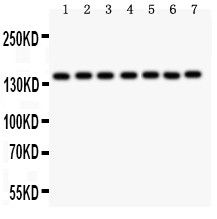 PARP1 Antibody - PARP antibody Western blot. All lanes: Anti PARP at 0.5 ug/ml. Lane 1: COLO320 Whole Cell Lysate at 40 ug. Lane 2: U87 Whole Cell Lysate at 40 ug. Lane 3: HT1080 Whole Cell Lysate at 40 ug. Lane 4: SKOV Whole Cell Lysate at 40 ug. Lane 5: HELA Whole Cell Lysate at 40 ug. Lane 6: PC12 Whole Cell Lysate at 40 ug. Lane 7: NIH Whole Cell Lysate at 40 ug. Predicted band size: 113 kD. Observed band size: 150 kD.