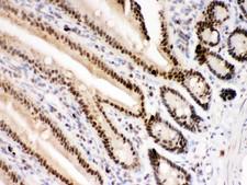 PARP1 Antibody - PARP antibody IHC-paraffin: Mouse Intestine Tissue.