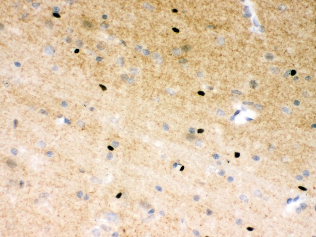 PARP1 Antibody - PARP antibody IHC-paraffin: Rat Brain Tissue.