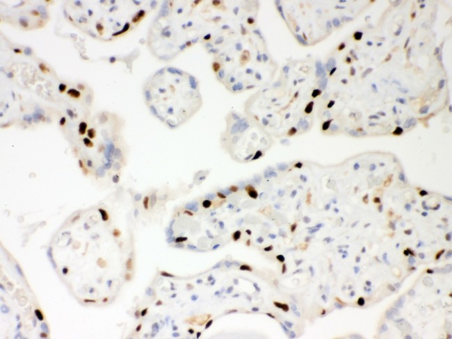 PARP1 Antibody - PARP antibody IHC-paraffin: Human Placenta Tissue.