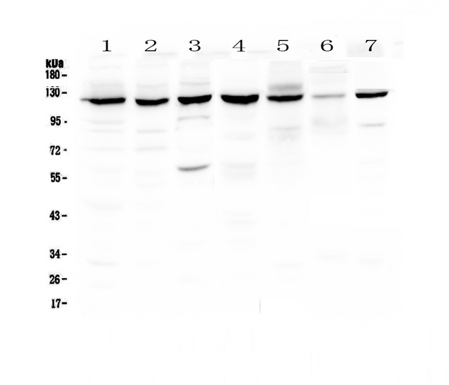 PARP1 Antibody - Western blot analysis of PARP using anti-PARP antibody. Electrophoresis was performed on a 5-20% SDS-PAGE gel at 70V (Stacking gel) / 90V (Resolving gel) for 2-3 hours. The sample well of each lane was loaded with 50ug of sample under reducing conditions. Lane 1: human Hela whole cell lysates, Lane 2: human HepG2 whole cell lysates, Lane 3: human COLO-320 whole cell lysates, Lane 4: human Jurkat whole cell lysates, Lane 5: rat PC-12 whole cell lysates, Lane 6: mouse NIH3T3 whole cell lysates, Lane 7: mouse HEPA1-6 whole cell lysates. After Electrophoresis, proteins were transferred to a Nitrocellulose membrane at 150mA for 50-90 minutes. Blocked the membrane with 5% Non-fat Milk/ TBS for 1.5 hour at RT. The membrane was incubated with rabbit anti-PARP antigen affinity purified polyclonal antibody at 0.5 µg/mL overnight at 4°C, then washed with TBS-0.1% Tween 3 times with 5 minutes each and probed with a goat anti-rabbit IgG-HRP secondary antibody at a dilution of 1:10000 for 1.5 hour at RT. The signal is developed using an Enhanced Chemiluminescent detection (ECL) kit with Tanon 5200 system. A specific band was detected for PARP at approximately 120KD. The expected band size for PARP is at 113KD.
