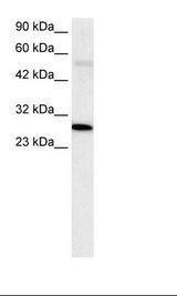PARP1 Antibody - Jurkat Cell Lysate.  This image was taken for the unconjugated form of this product. Other forms have not been tested.