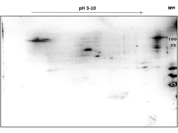 PARP1 Antibody - OVCAR-8 Wild Type Lysate separated on 2D SDS-PAGE and blotted on PVDF to analyze immunocoverage of PARP1 antibody specific for the autocatalytic domain of PARP1. Primary Antibody: Anti-PARP1 (internal) antibody 1:200 overnight at 4°C. Secondary Antibody: Goat anti-rabbit Peroxidase at 1:2,000 at RT for 30min. Blocking Buffer: BlockOut for 30min at RT. Predicted/observed: ~110 kDa and pI 9.7. Other spots detected: cleavage products of PARP1.