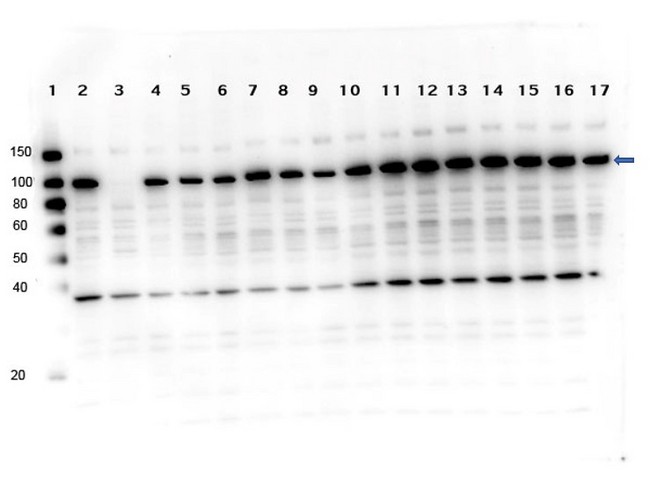 PARP1 Antibody - Western Blot of rabbit anti-PARP1 antibody. Lane 1: Molecular Weight ladder. Lane 2: OVCAR-8 Wild Type. Lane 3: PARP1-KO. Lane 4: PARP2-KO. Lane 5: PARP3-KO. Lane 6: PARP4-KO Lane 7: PARP5a-KO. Lane 8: PARP5b-KO. Lane 9: PARP6-KO. Lane 10: PARP7-KO. Lane 11: PARP8-KO. Lane 12: PARP9-KO. Lane 13: PARP10-KO. Lane 14: PARP12-KO. Lane 15: PARP13-KO. Lane 16: PARP14-KO. Lane 17: PARP16-KO. Load: 5.0 µg per lane. Primary antibody: PARP1 antibody at 1ug/mL overnight at 4°C. Secondary antibody: Goat anti-rabbit Peroxidase secondary antibody at 1:40,000 for 30 min at RT. Blocking Buffer: MB-073 for 30 min at RT. Predicted size: ~113kDa for PARP1. Observed nonspecific ~40kDa.